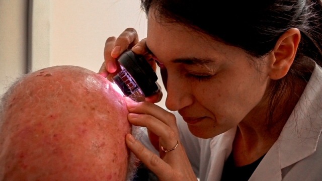 tratamiento del cáncer de piel