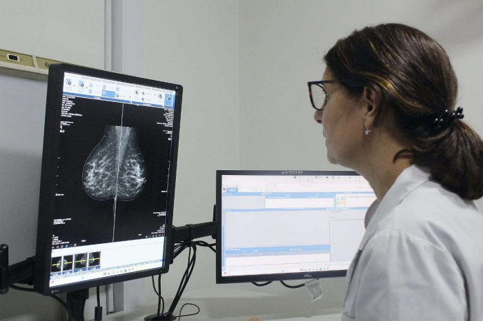 La Provincia sumó 22 mamógrafos.