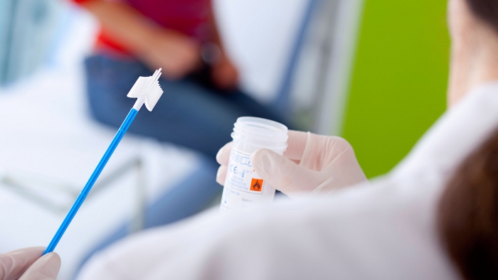 Chlamydia Test Symptoms Chlamydia Test Symptoms